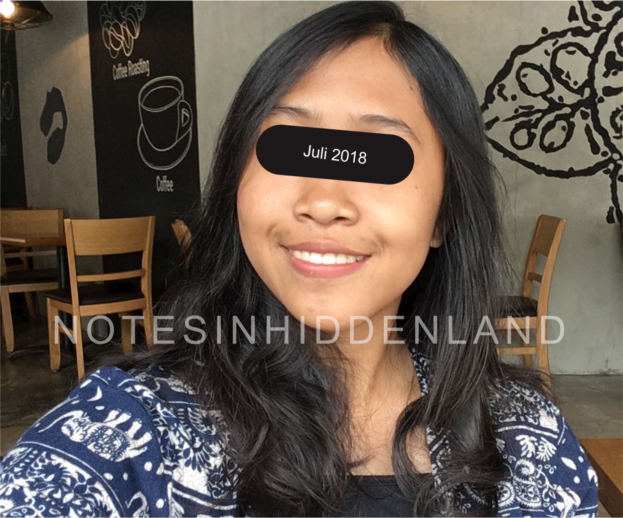 My Acne Journey! Part 1